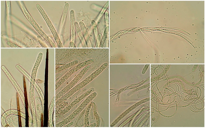 Acanthophiobolus helicosporus