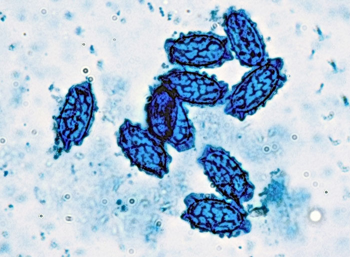 Aleuria luteonitens