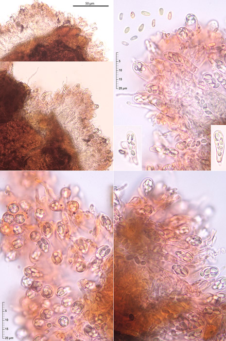 Ascocorticium anomalum