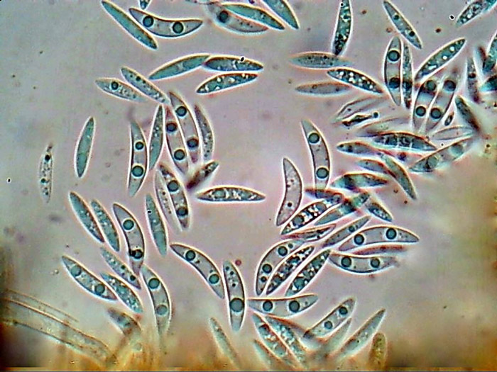 Erioscyphella lunata