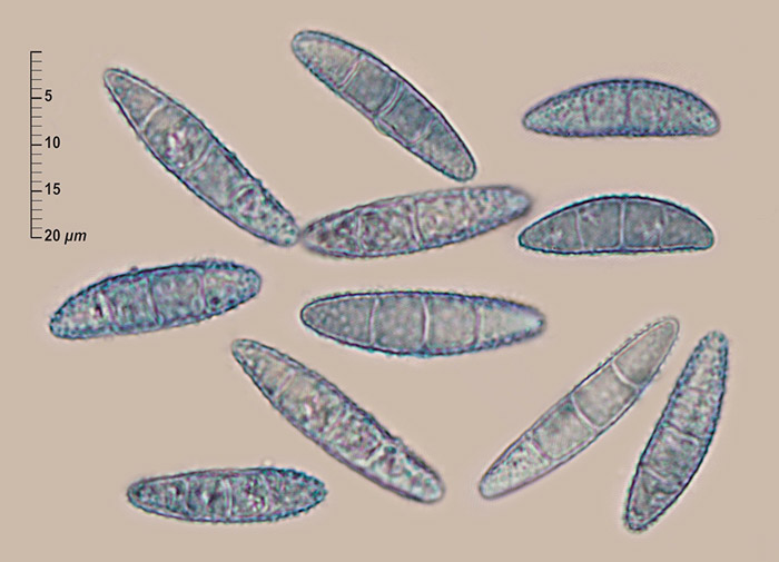 Flammocladiella decora