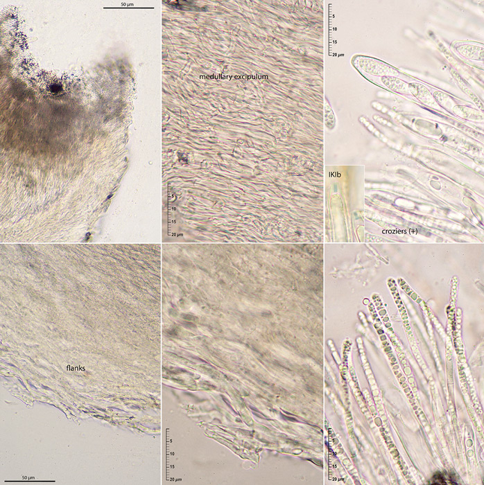 Hymenoscyphus calyculus