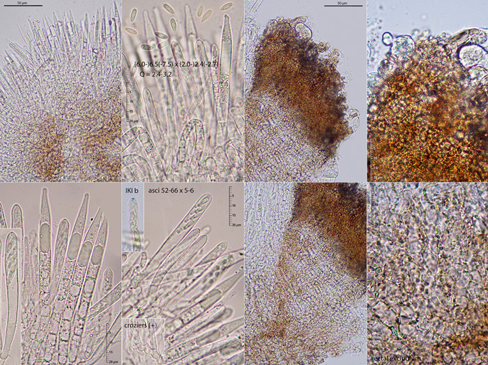 Hysterostegiella valvata