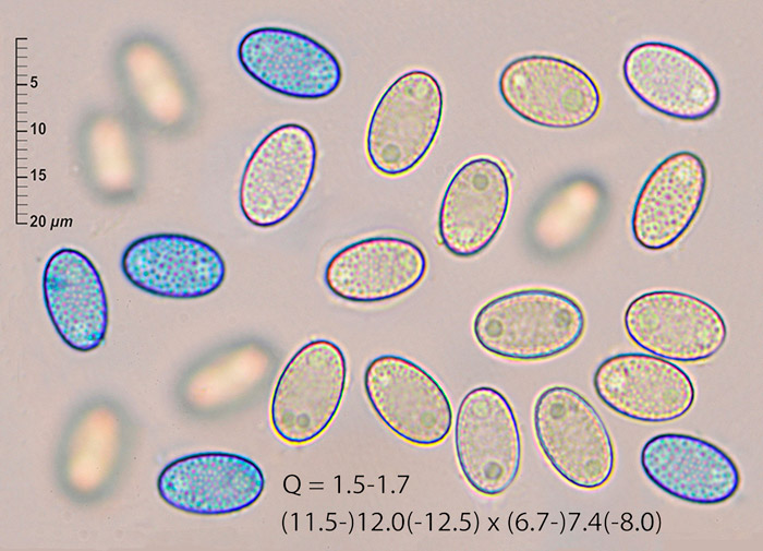 Peziza tenacella