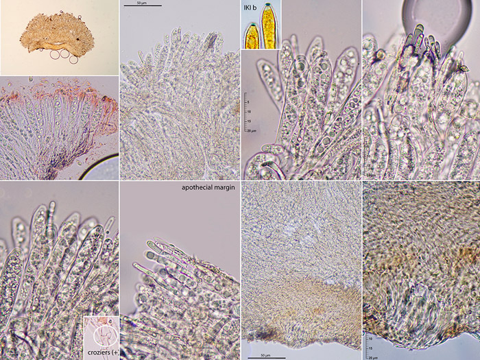 Rodwayella sessilis