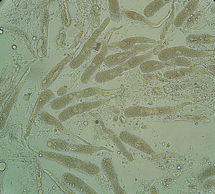 Aleurodiscus wakefieldiae Gleocistidios