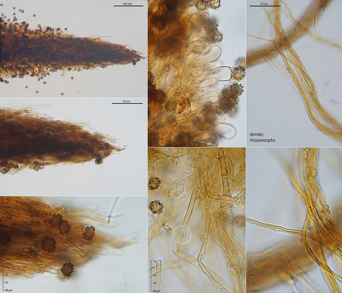 Tomentella crinalis