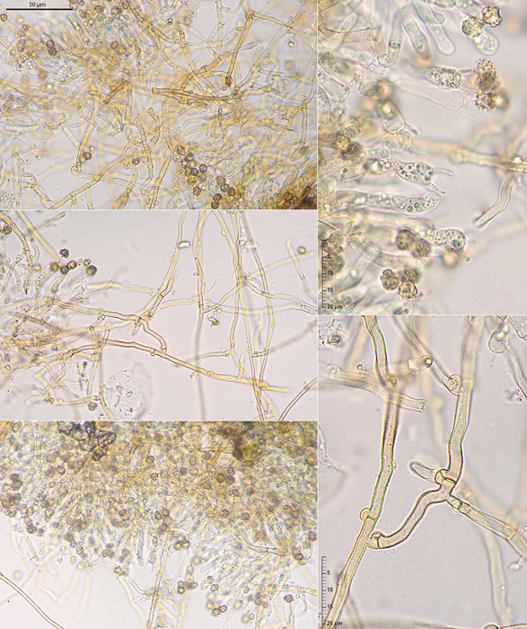 Tomentella ferruginea